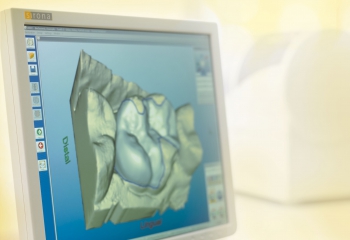 Cerec 3D Aufnahmeeinheit (Bildquelle: Sirona dental Systems)
